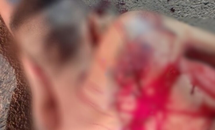 Alta Floresta – Homem é esfaqueado e encontrado desacordado em cruzamento
